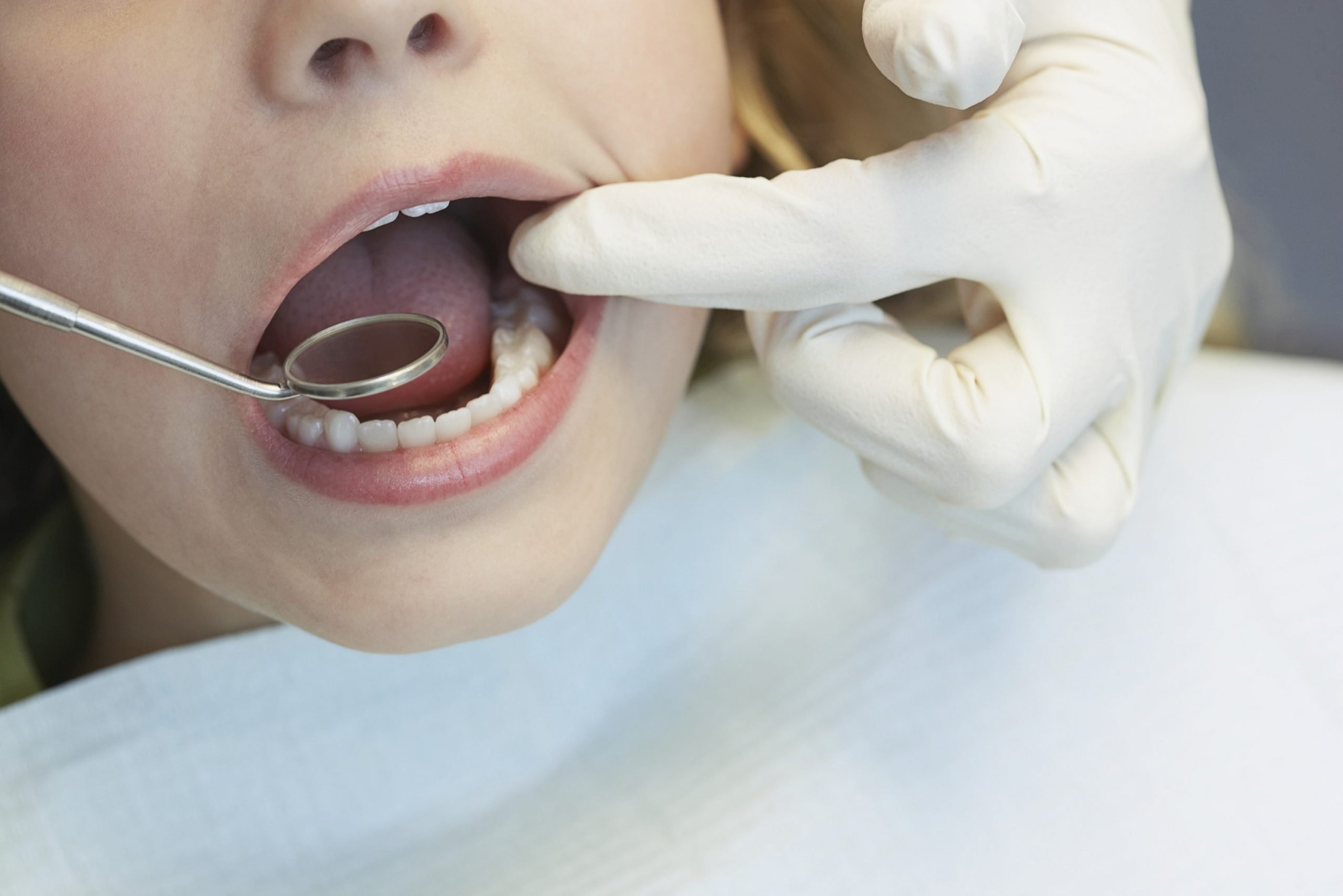 Turma do Bem e Colgate selecionam jovens para tratamento odontológico gratuito em Jaguariúna